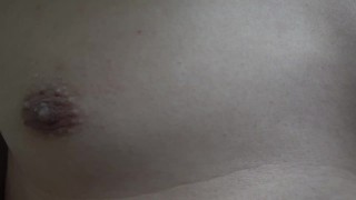 hair removal arround nipples