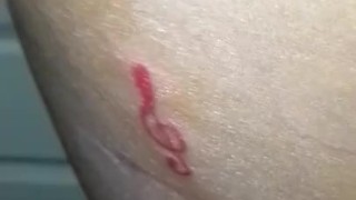 Tatts