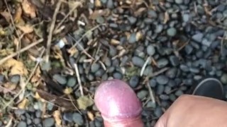 My little phimosis penis erects