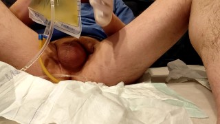 taking out the catheter and the enema with your own urine