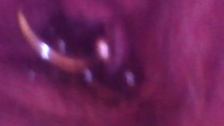 Close up otoscope endoscope pee peeing urine piss pissing