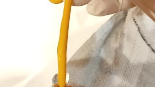 urinary catheter insertion and piss