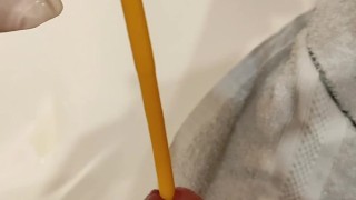 removal of a urological catheter