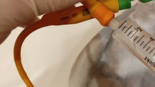 removal of a urological catheter