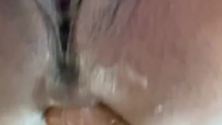 All anal