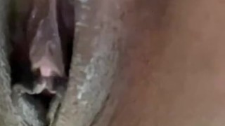 All anal