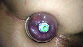 Anal pumping with a small pump