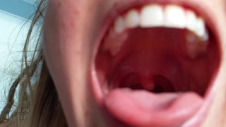 Tour of my drooly mouth