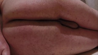 Retention Enema and Release 02