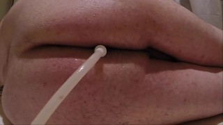 Retention Enema and Release 02