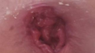 my anal is so lose and broken i cant hold anything in