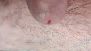 Urethral sounding close up