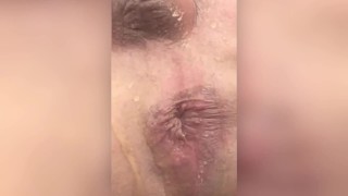 PISSING ON ASSHOLE EXTREME CLOSE UP