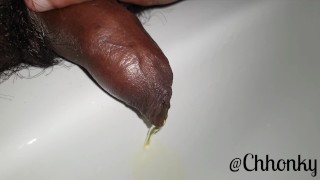 Close Up With My Uncut Pissing Cock