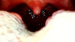 My throat with endoscope