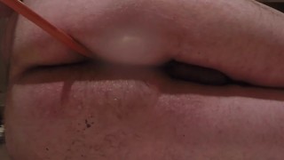 Retention Enema and Release 03