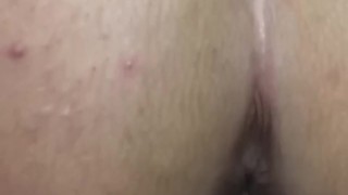Anal closeup 
