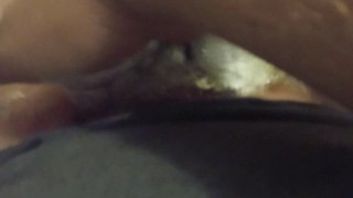 Putting on diaper rash cream on my baby parts