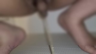 包茎がおしっこした後に皮を剥いた