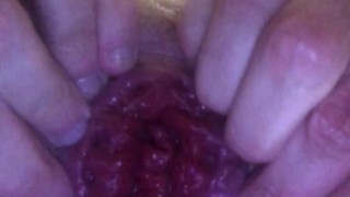 18 YEAR OLD EXTREME ANAL PROLAPSE, MASSIVE ASS HOLE FUCKED BY BBC