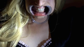 MOUTH GAG POV LEAKED