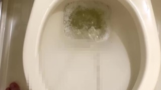 パンパンの膀胱からおしっこ