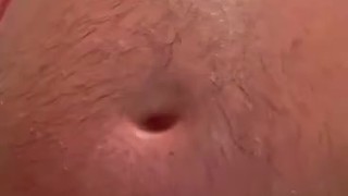 Sunburn