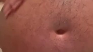 Sunburn