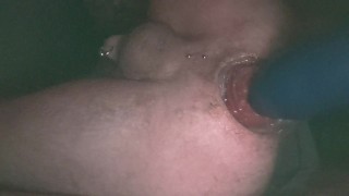 gay guy stuffs hole and prolapses