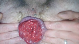 Gay guy plays with his cummy prolapse