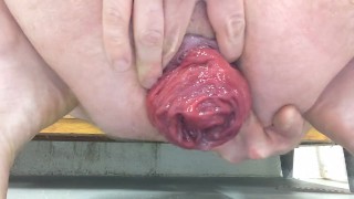 Gay guy pushes out and shows off giant rosebud prolapse - CLOSEUP