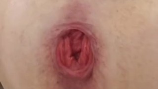 Anal Fuck, Gape, Dildo - 16
