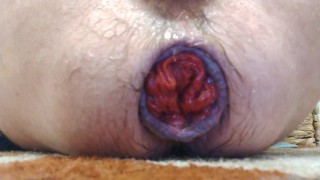 Gay rosebud stretch (part 1)