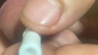 尿道异物插入
