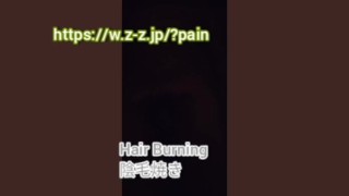 Hair Burning