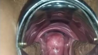 Ginecólogo va a mi casa y me filma
