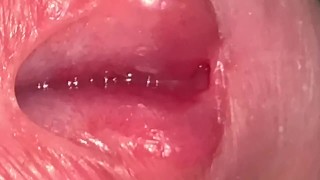 Urethral Examination 