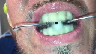 Piss and cum facial on my huge vanbeek braces