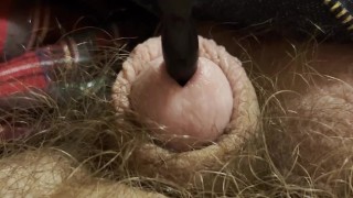 Painful sound removal ends with golden surprise