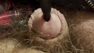 Painful sound removal ends with golden surprise