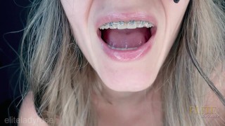 Joi for braces