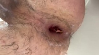 Anal gape in shower 