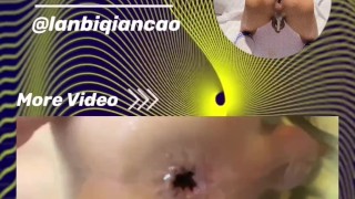烂逼欠操｜贱狗肉便器被大鸡巴随意玩操 - 03