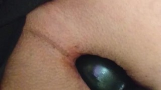 バルーンプラグでアナル拡張　Good or Bad