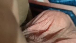 Yeast infection and fungus infection treatment. I fucked my fake pussy hole and got the infection.