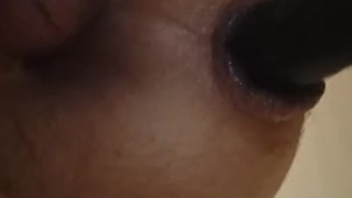 Anus dilatation 