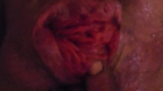 Extreme close up of my dripping my asshole