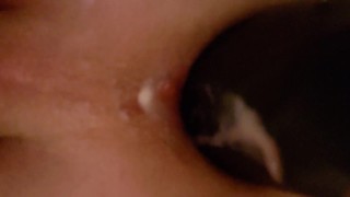 Anal gape close up