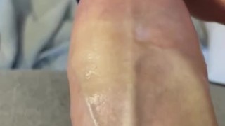 Thick veins