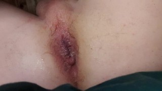 solo anal dilatation